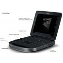 SONOSITE Edge II - Sale